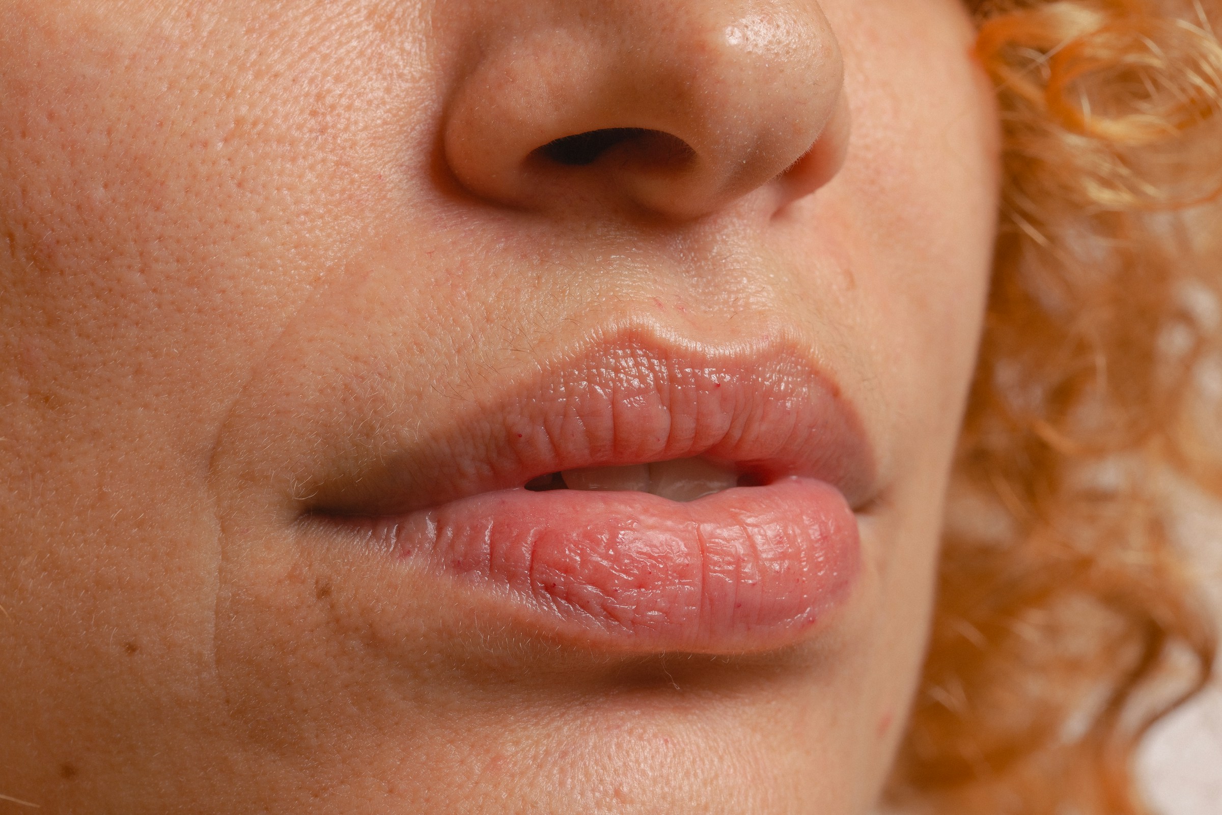 “Har jag herpes?” Här är vanliga signaler att ha koll på – och hur du testar dig