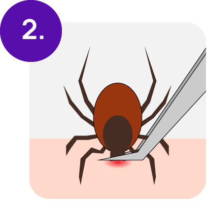2. Grip as close to the skin as possible