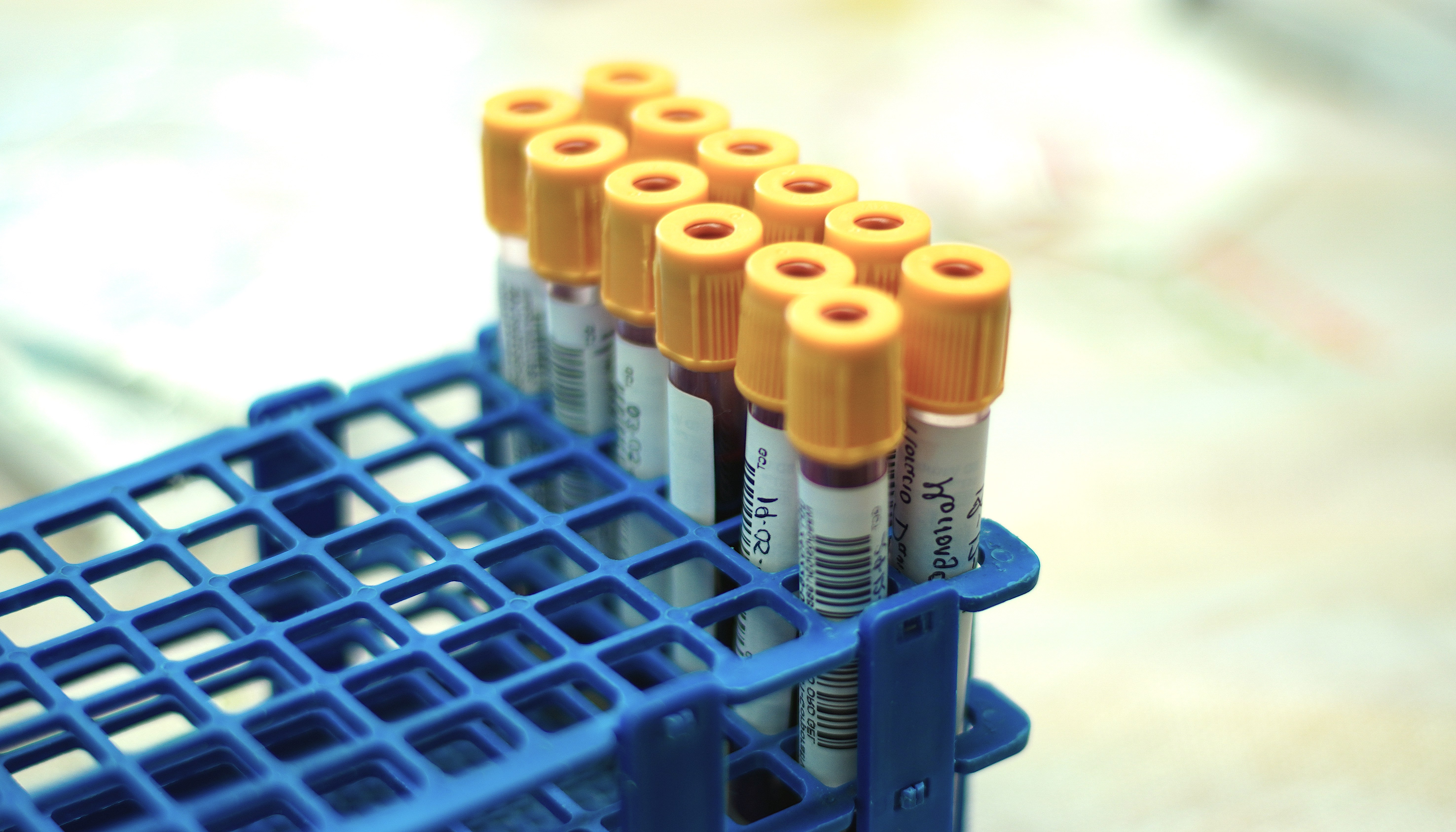 How do I measure creatine in the body? The difference between creatine and creatinine