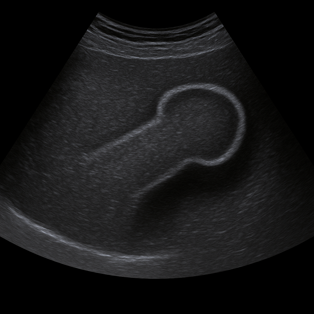 Ultrasound Penis