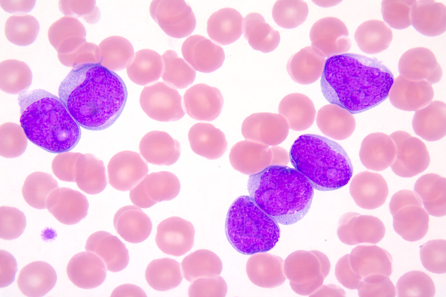 Leukocytes – An overview of the different types and their importance