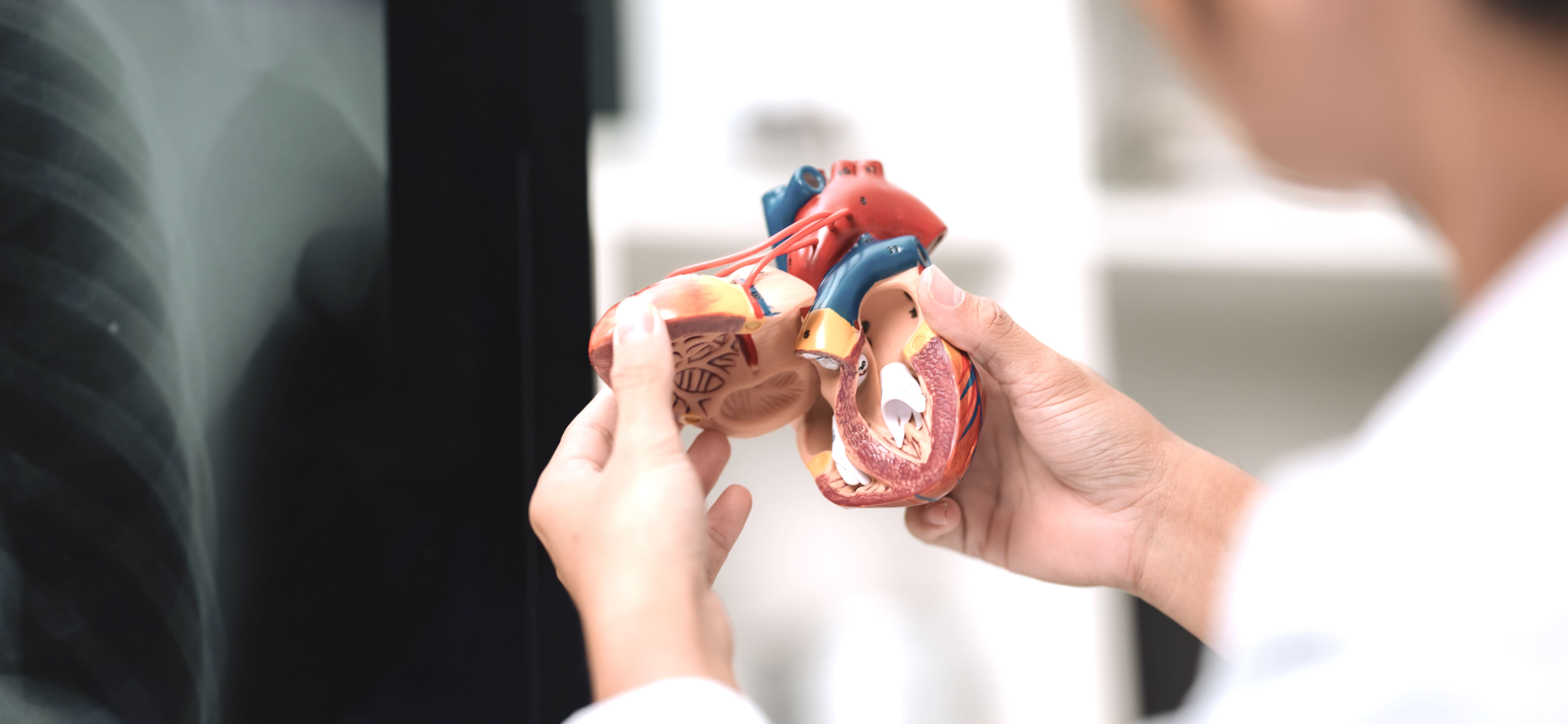 CT hjärta med calcium score – undersökning för att upptäcka tidig åderförkalkning