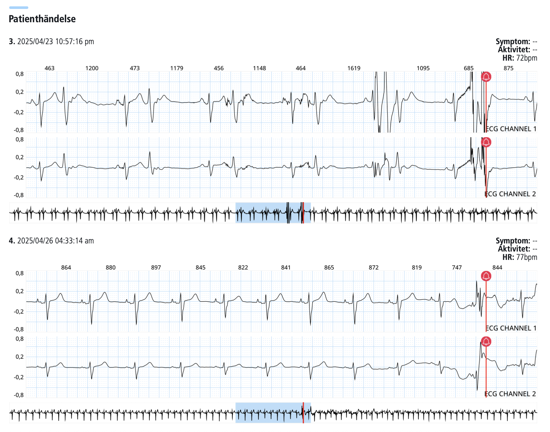 Vad Visar Ett L ngtids EKG Testmottagningen