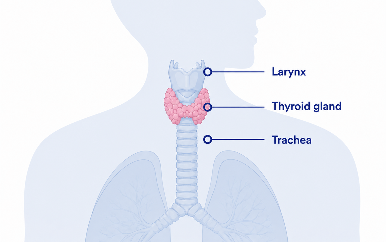 illustration of thyroid tumor