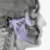 MRI Temporomandibular joints