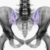 MRI Hip joint and pelvis