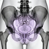 MRI Pelvis