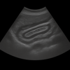 Ultrasound Abdominal