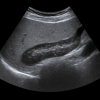 Ultrasound Pancreas
