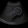 Ultrasound Penis