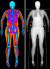DEXA body scan