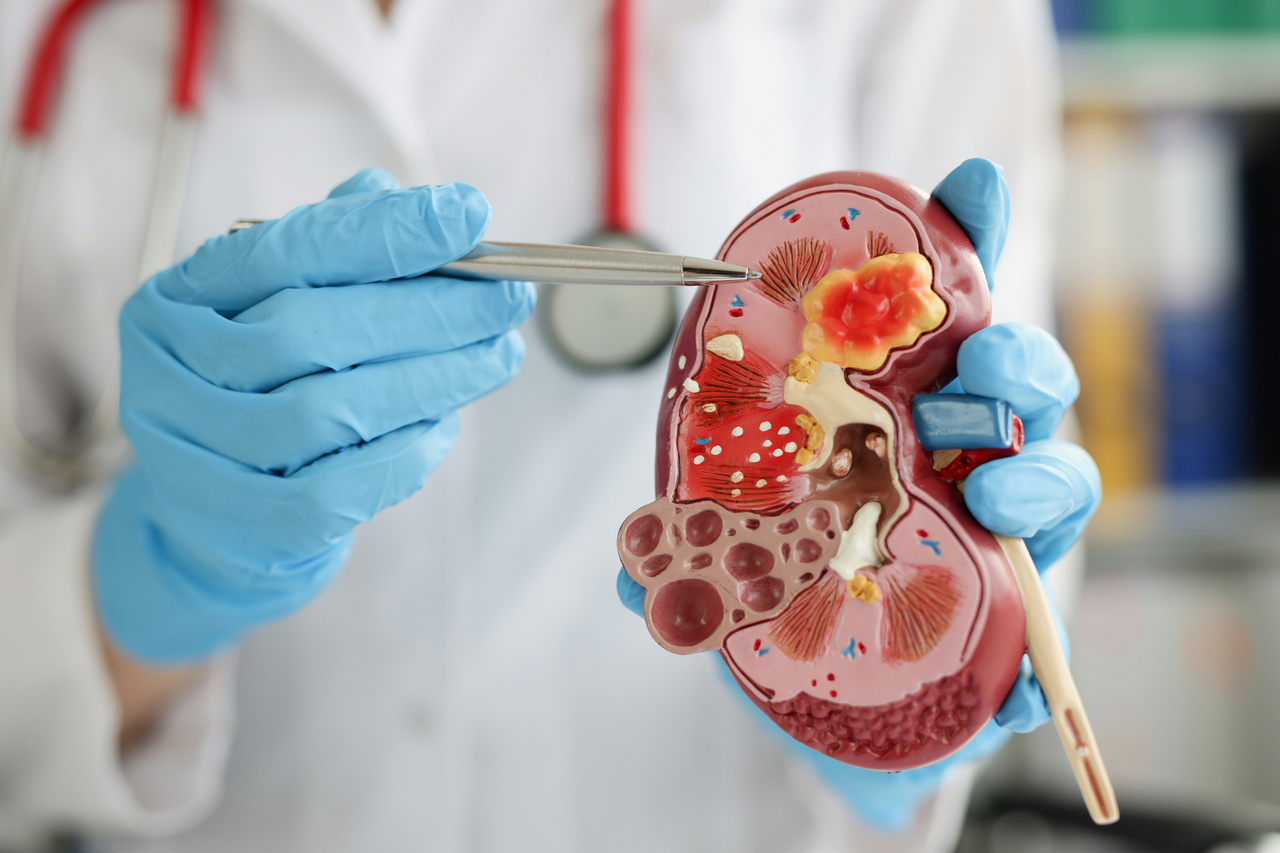 Kidney failure - How to interpret abnormal blood tests