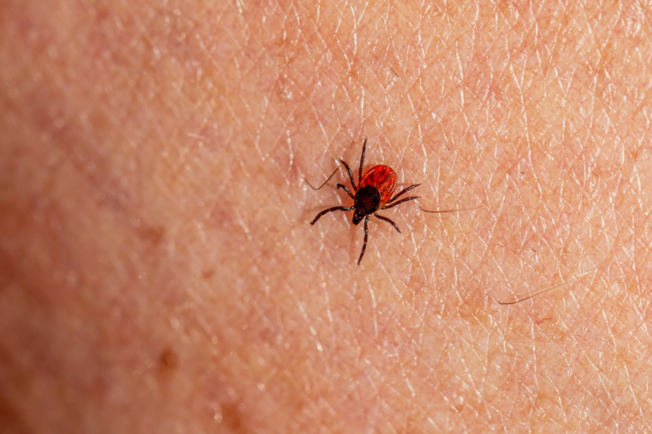 “Is it dangerous if the tick's head is still attached?” And 9 other frequently asked questions and answers about ticks
