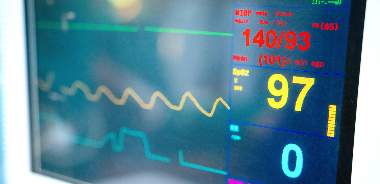What does a Long-Term ECG show?