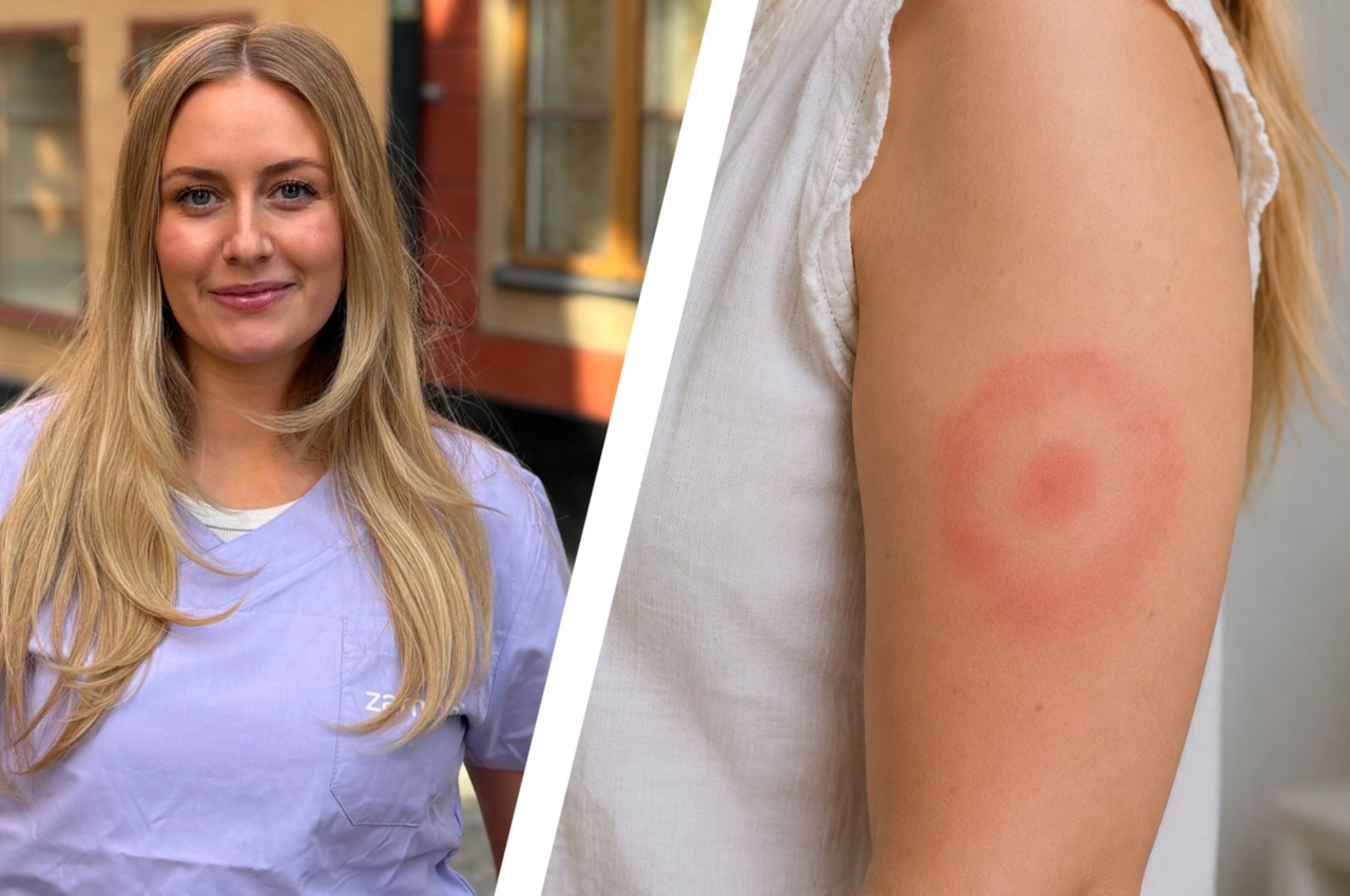 Borrelia och fästingbett – när ska du reagera? Läkaren svarar