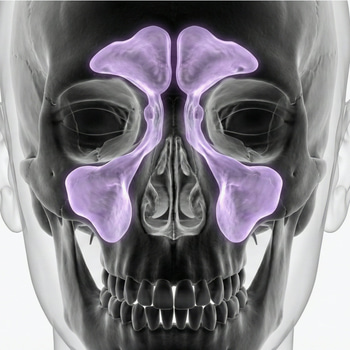 MR Sinus