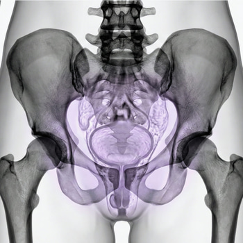 MRI Pelvis