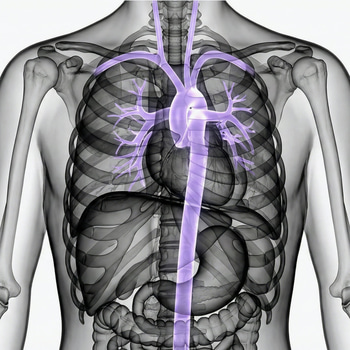 MR Aorta