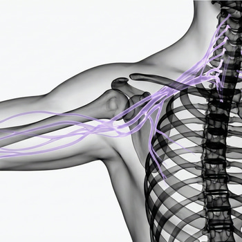 MR Plexus brachialis