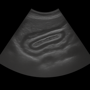 Ultrasound Abdominal