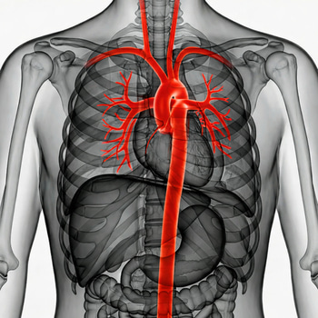 CT Aorta