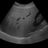 Ultraljud Liver