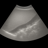 Ultrasound Liver Elastography