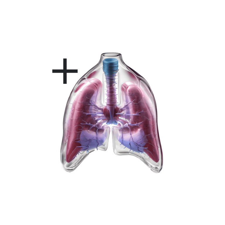 Tyreoglobulin antikroppar