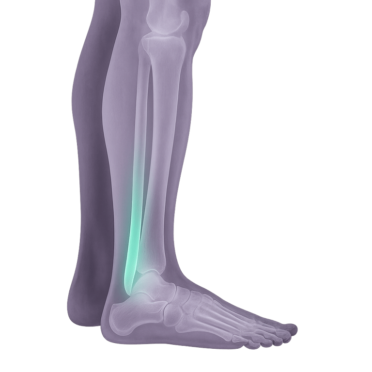 MR Achilles tendon