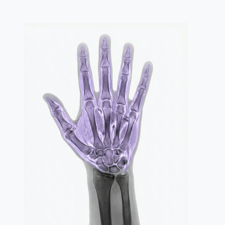 MR Hand
