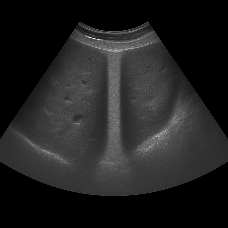 Ultrasound Biliary tract