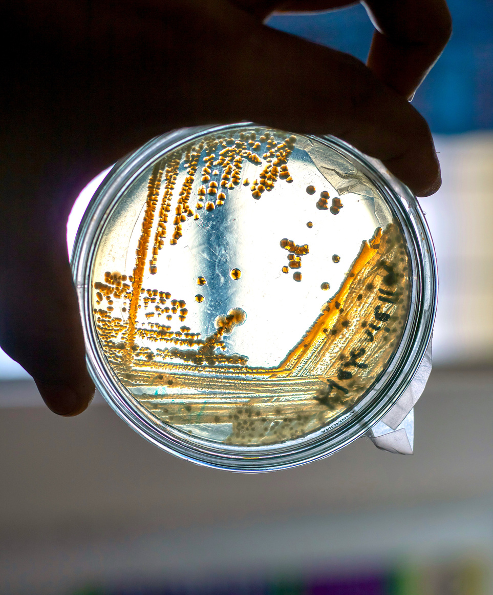 Listeria – the invisible guest on your dinner table