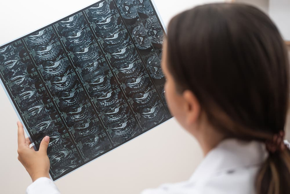 Unexplained change in the spleen – what does it mean?